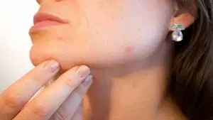 Bases farmacológicas e interações medicamentosas na estética