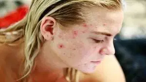 Disfunções dermatológicas aplicadas à estética II