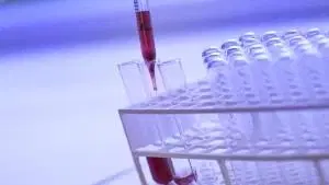 Hematologia Clínica