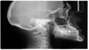 Radiologia (Imaginologia)