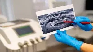Radiologia Odontológica e Imaginologia